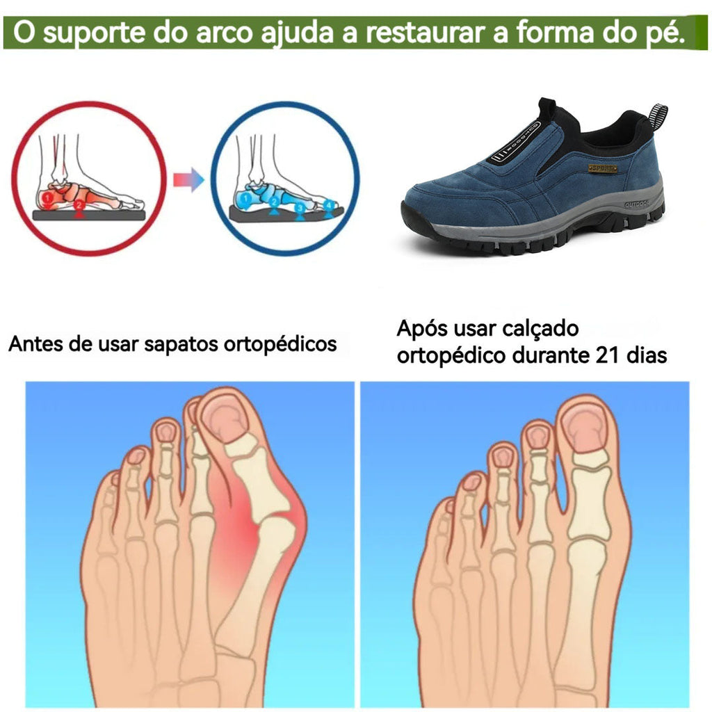 BIAOTOK® – Scarpe ortopediche mediche dal design ergonomico che alleviano il dolore alla schiena, alle articolazioni e alle gambe.